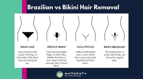 laser hair removal bikini vs brazilian